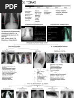 Radiografía de Toráx