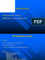 Bradiaritmii