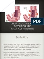 Diverticulosis!!