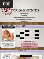 CORIOAMNIONITIS