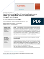 Manifestaciones Radiográficas de Las Atelectasias Pulmonares Lobares en La Radiografía de Tórax y Su Correlación Con La Tomografía Computarizada