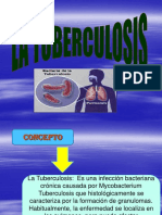 Tuberculosis Trabajo Completo