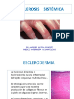 Esclerosis Sistemica2