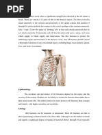 Rib Fracture