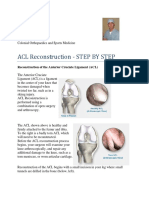 Vivek Sharm Acl Reconstruction