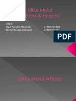 Ulkus Mulut (Aftosa, Herpes)