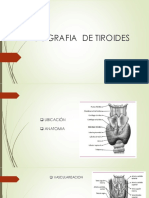 Ecografia de Tiroides