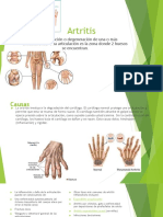 Artritis PDF