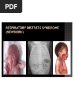 Respiratory Distress Syndrome (Newborn)