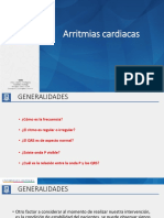 Arritmias Cardiacas