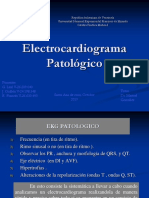 Ekg Patologico2