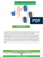 Trombosis Venosa Profunda - Patologia