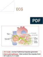 ECG Arrythemia