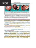 Gestational Troophoblastic Disease Notes