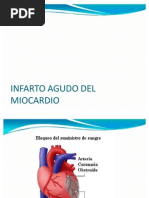 Infarto Agudo Del Miocardio Power Point