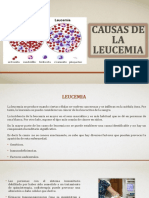 Causas de La Leucemia