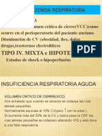 Insuficiencia Respiratoria