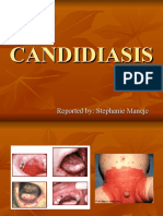 CANDIDIASIS