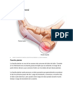 Fascitis Plantar