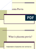 Placenta Previa Abruptio