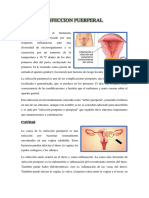 Infeccion Puerperal