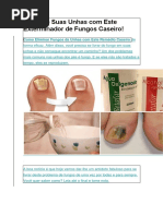 Acabe Com Fungos Das Unhas