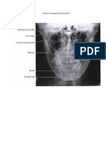 Kritisi Mandibula