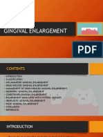 Gingival Enlargement - Del