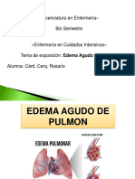 Edema Pulmonar