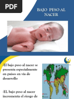 Bajo Peso Al Nacer