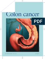 Colon Cancer