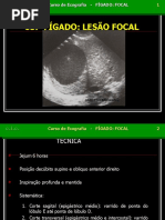 Figado Focal