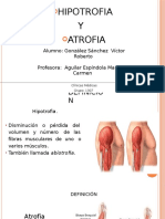 Hipotrofia y Atrofia