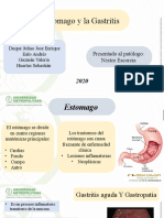 Gastritis Aguda y Gastropatia, Lesion Por Estres