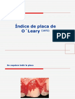 Indice de Placa Bacteriana