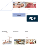 Mapa Mental de Valoracion en Recien Nacido Engelbert
