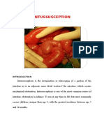 INTUSSUSCEPTION