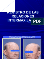 Relacionesintermaxilaresenprotesistotal 130413173126 Phpapp01 PDF