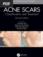 Acne Scars Classification and Treatment