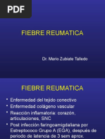 T4 - Fiebre Reumatica - DR Zubiate