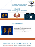 Litiasis Renal