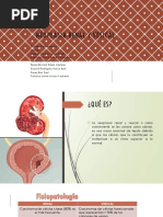 Equipo 4 Neoplasia Renal y Vesical