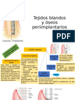 Implantes Dentales