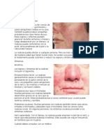 ROSACEA