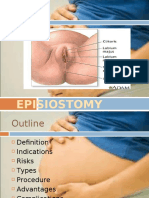 Episiotomy