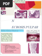 NECROSIS PULPAR Inicio