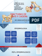 Fracturas de Pelvis y Cadera