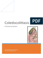 Coledocolitiasis