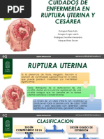 Cuidados de Enfermería en Ruptura Uterina y Cesárea