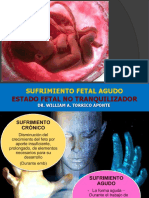 Sufrimiento Fetal Agudo: Estado Fetal No Tranquilizador